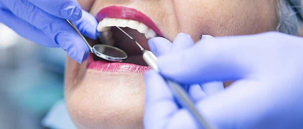 Best Emergency Dentist for Lost Fillings or Crowns in Midlothian, TX