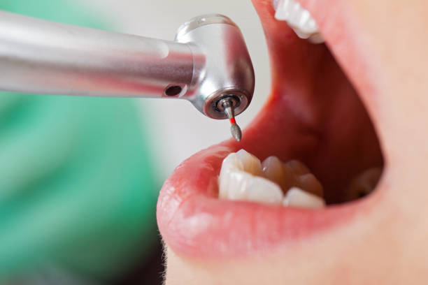 Best Emergency Cosmetic Dentistry in Midlothian, TX